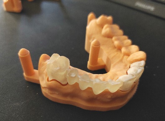 Millatech Laboratorio Odontoiatrico produzione